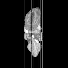 sagittal slice image map