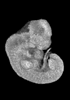 day 33 human embryo MRI animation