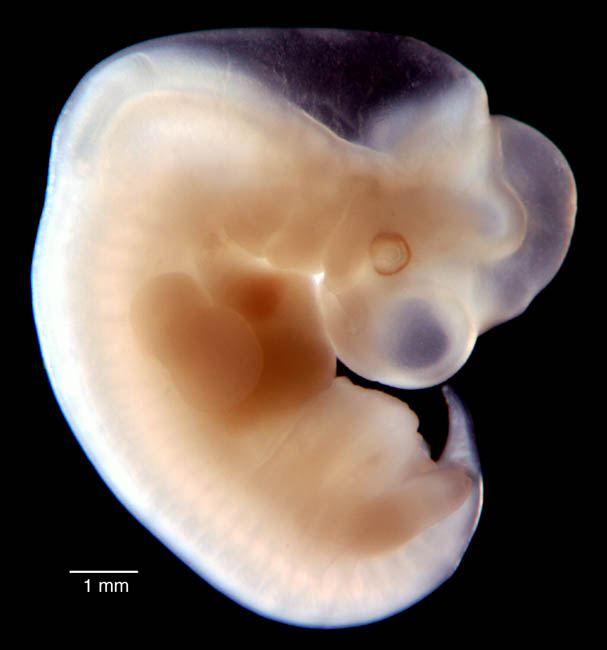 human embryo photograph