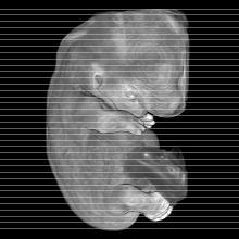 axial slice image map