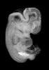 day 47 human embryo MRI animtaion