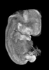 day 47 human embryo MRI animtaion