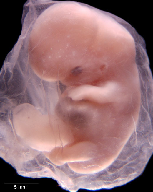 human embryo photograph