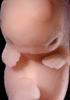 day 47 human embryo photograph