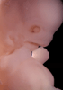 day 47 human embryo photograph