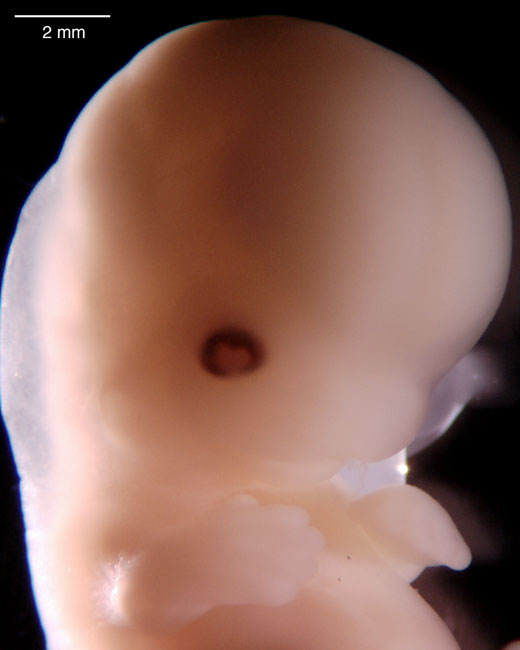 human embryo photograph