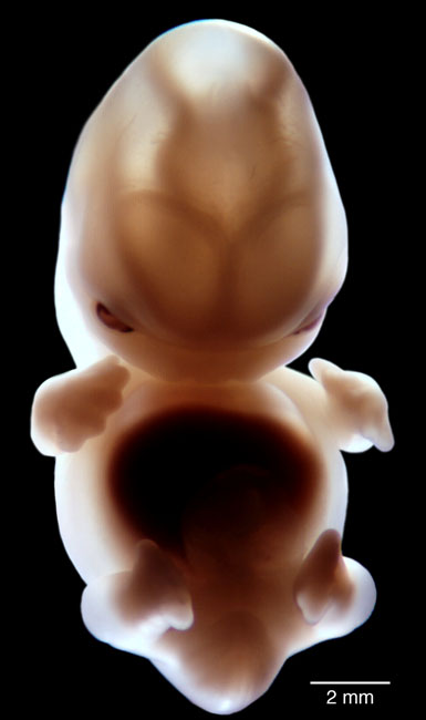 human embryo photograph