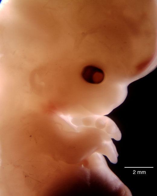 human embryo photograph