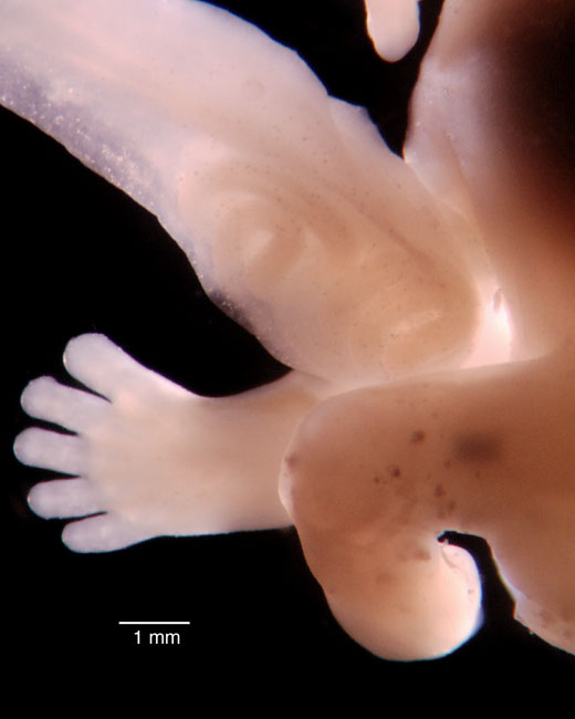 human embryo photograph